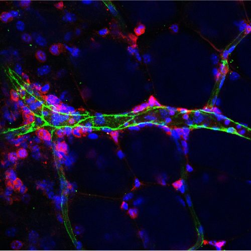 leukocyte leukocyte